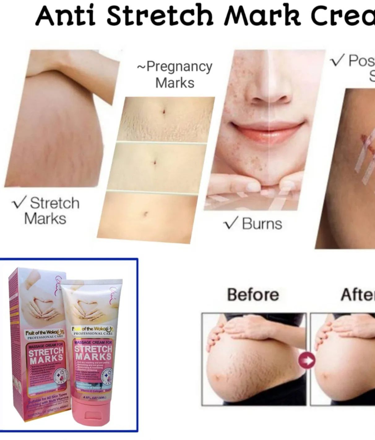 Fruit of the wokali Professional care Massage cream for Stretch marks